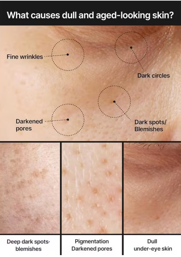 Celimax Pore + Dark Spot Brightening Cream