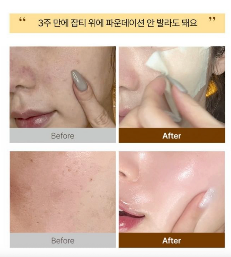 Shaishaishai Caffeine Shot Vita C Bubble Serum 110ml