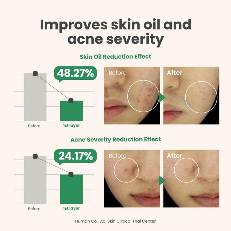 AXIS-Y Spot The Difference Blemish Treatment | 15 ml