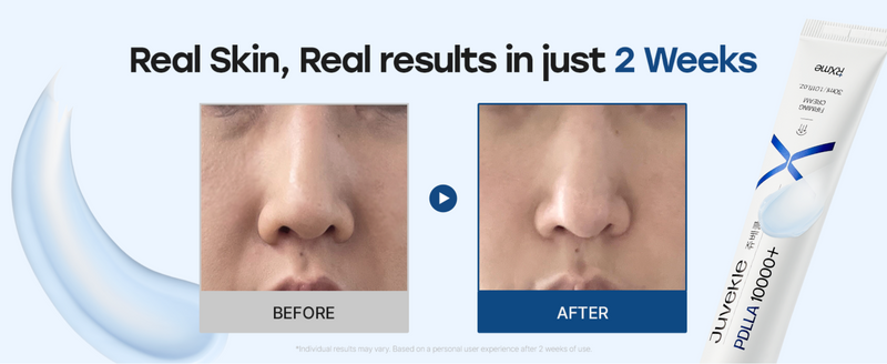 RXme Juvekle PDLLA 10000+ Firming Cream (30 ml)
