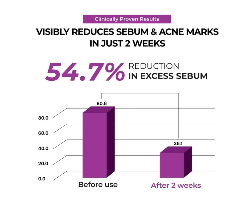 JUMISO Niacinamide 2+ Oil Control Cream 80ml