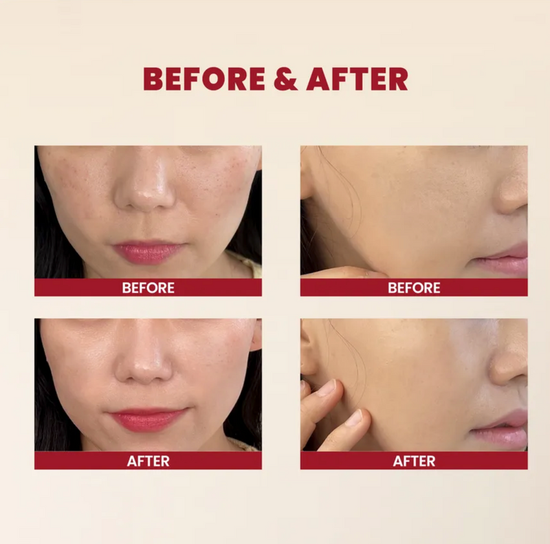 KSECRET Seoul 1988 Essence: Snail Mucin 97% + Rice | Repair & Brightening Essence | 100ml