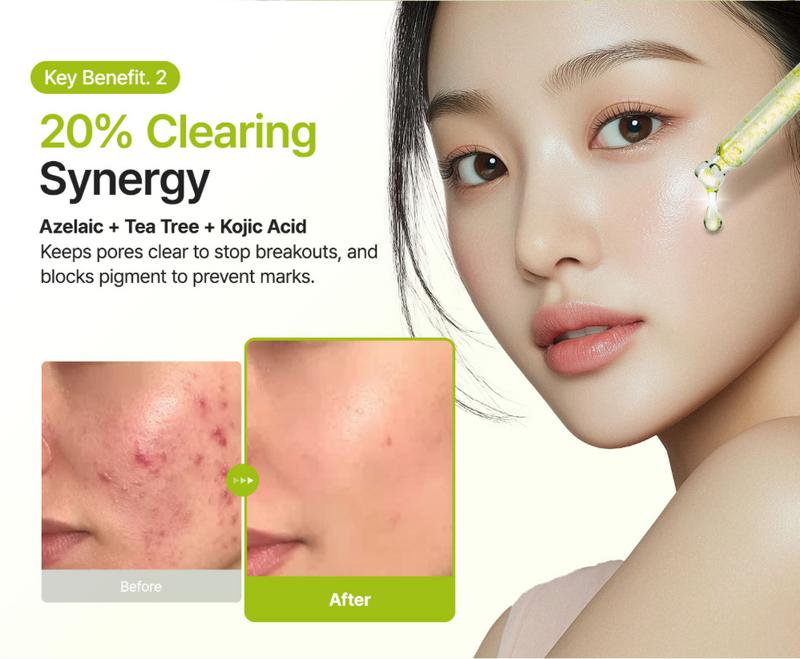 Purito Azelaic Acid 10 Kojic Tea Tree Serum 30 mL