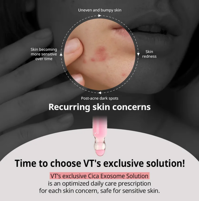 VT Azelaic Acid Cica Exosome Serum | Clarifying & Barrier Repair Serum | 30ml