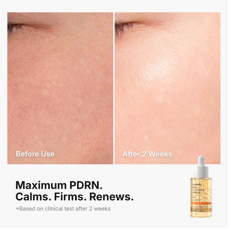 Genabelle PDRN Vita Toning Ampoule | Brightening PDRN Vitamin Capsule Serum | 30ml