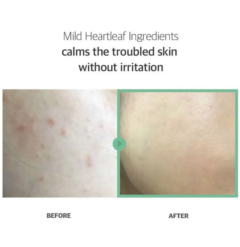Celimax Ji.Woo.Gae Heartleaf BHA Peeling Pad (60 Pads / 125ml)