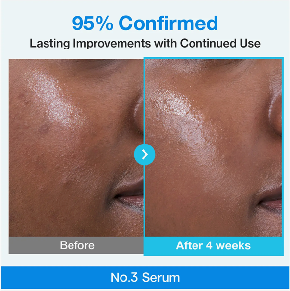 Numbuzin No.3 Blue Bio-Retinol Pore Refining Serum (30ml)