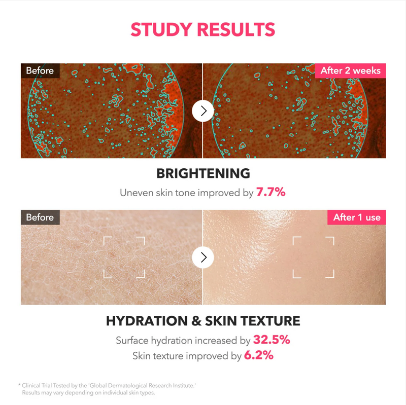 Aprilskin TXA + Niacinamide 99 Pink Milky Toner (150ml)