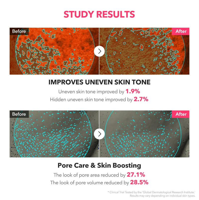 Aprilskin TXA Niacinamide Toning Shot 99 Spicule Serum (30ml)