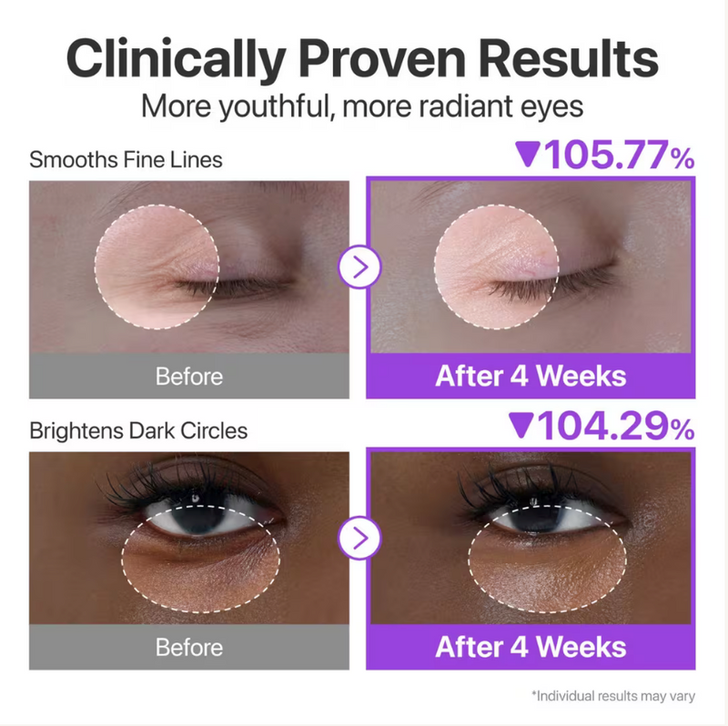 Numbuzin No.9 NAD+ Retinol Volumetox Eye Cream (10ml)
