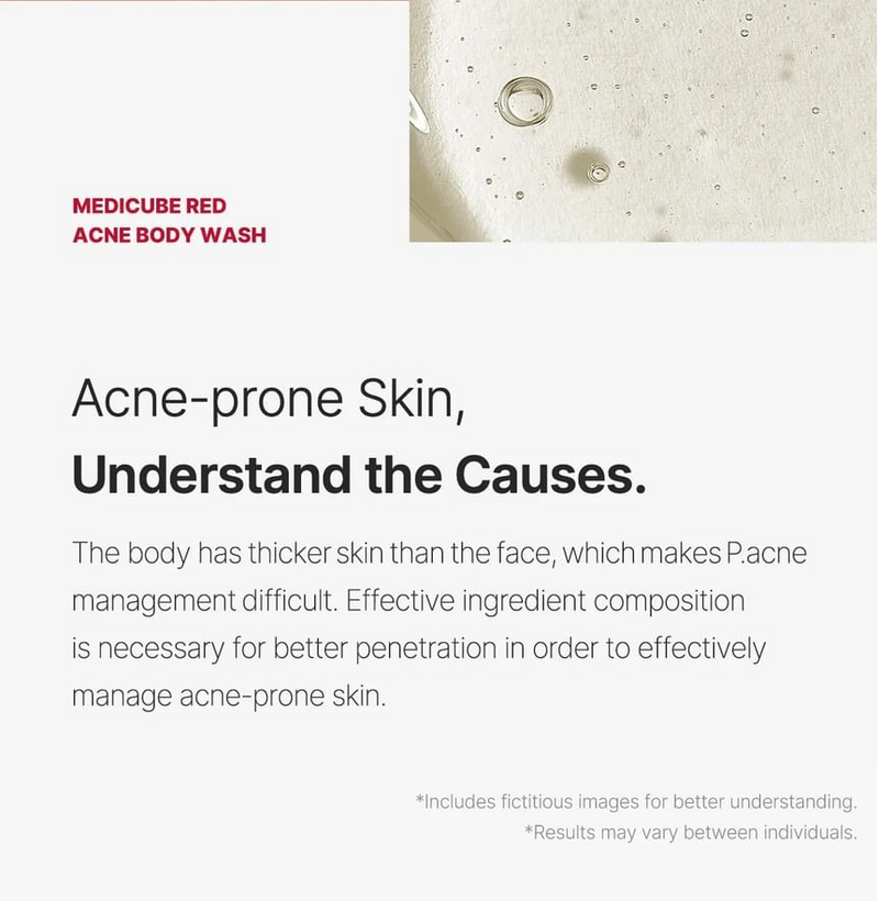 Medicube Red Acne Body Wash AHA BHA PHA Niacinamide 400 g